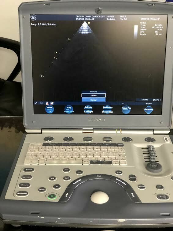 GE 10S-RS Sector Array Probe