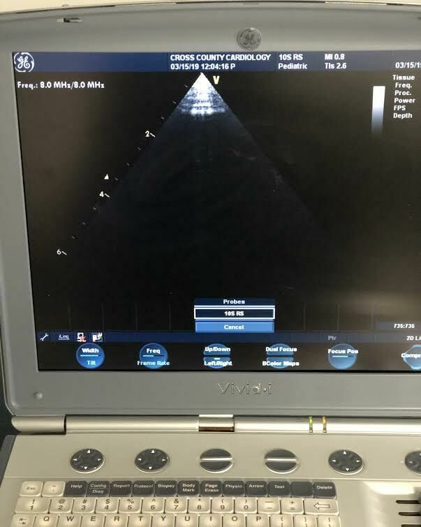 GE 10S-RS Sector Array Probe