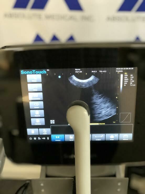 Chison Sonotouch 30 Portable Ultrasound Machine