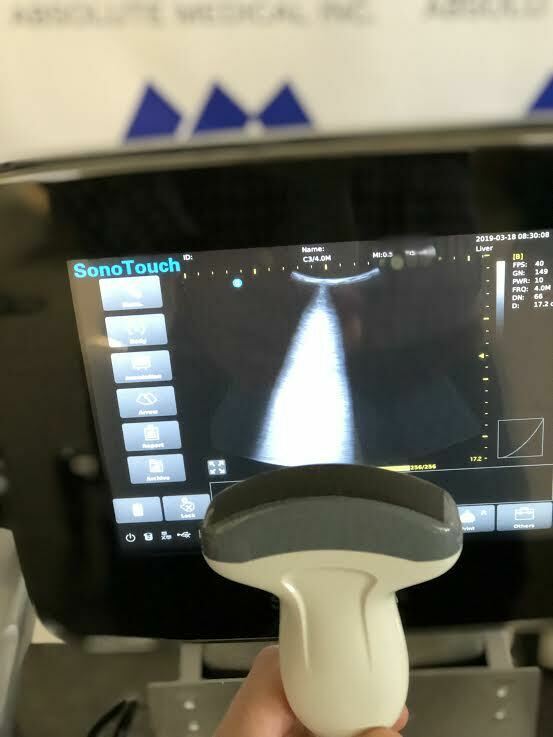 Chison Sonotouch 30 Portable Ultrasound Machine