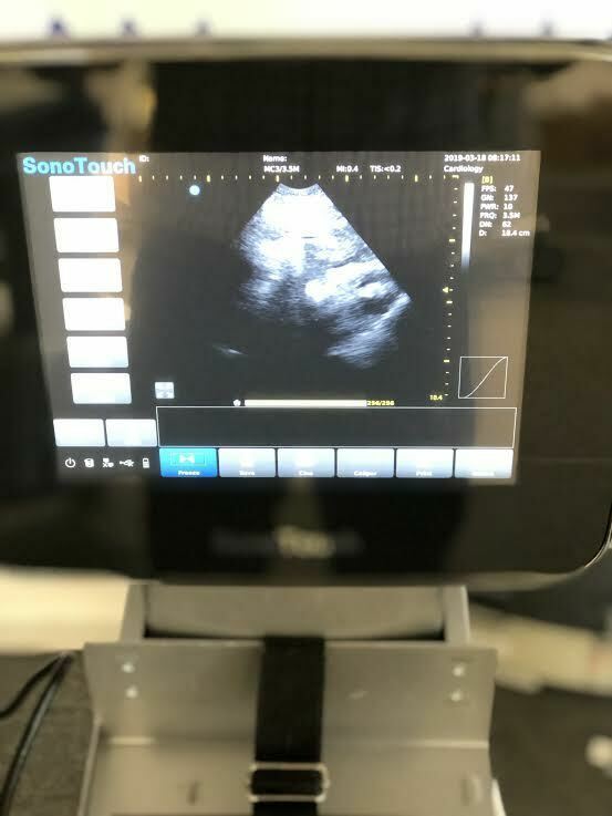 Chison Sonotouch 30 Portable Ultrasound Machine