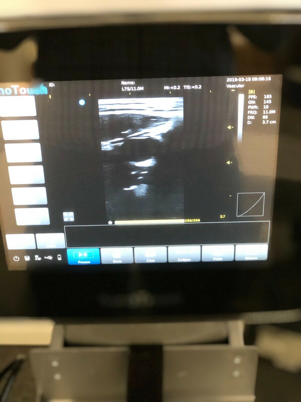 Chison L7s Linear Array Ultrasound Probe