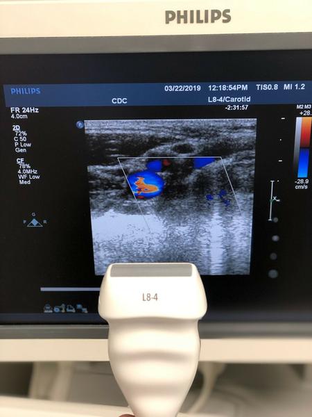 Philips L8-4 Linear Array Probe