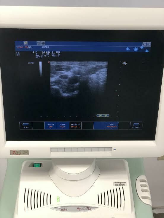 Esaote Biosound MyLab 20 Ultrasound Machine