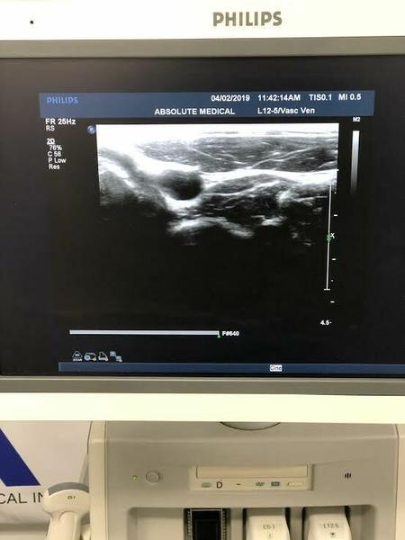 Philips L12-5 Linear Array Probe