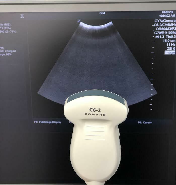 Zonare C6-2 Curved Array Ultrasound