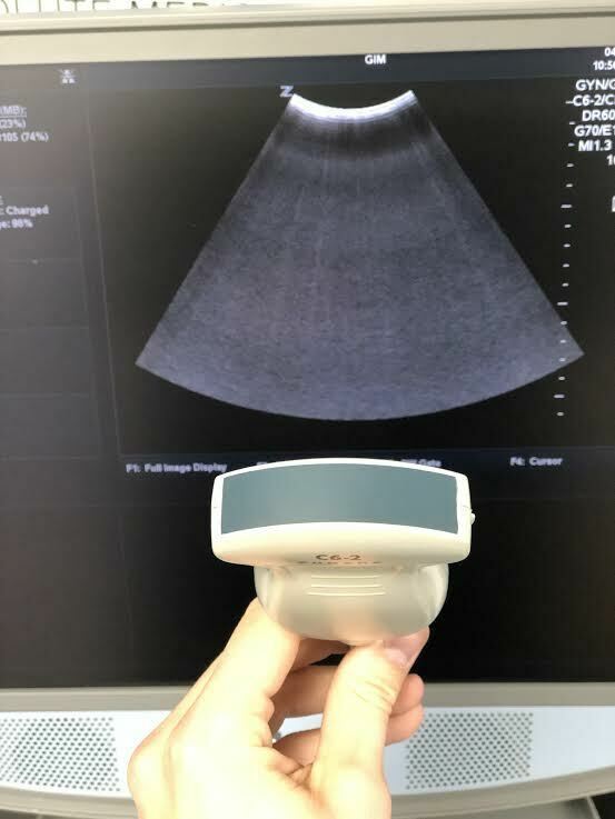 Zonare C6-2 Curved Array Ultrasound