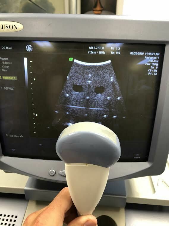 GE AB2-7 Curved Array Probe