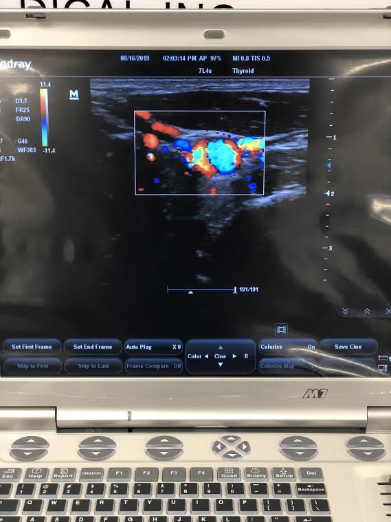 Mindray M7 Portable Ultrasound Machine