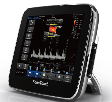 Chison Sonotouch 30 Portable Ultrasound Machine