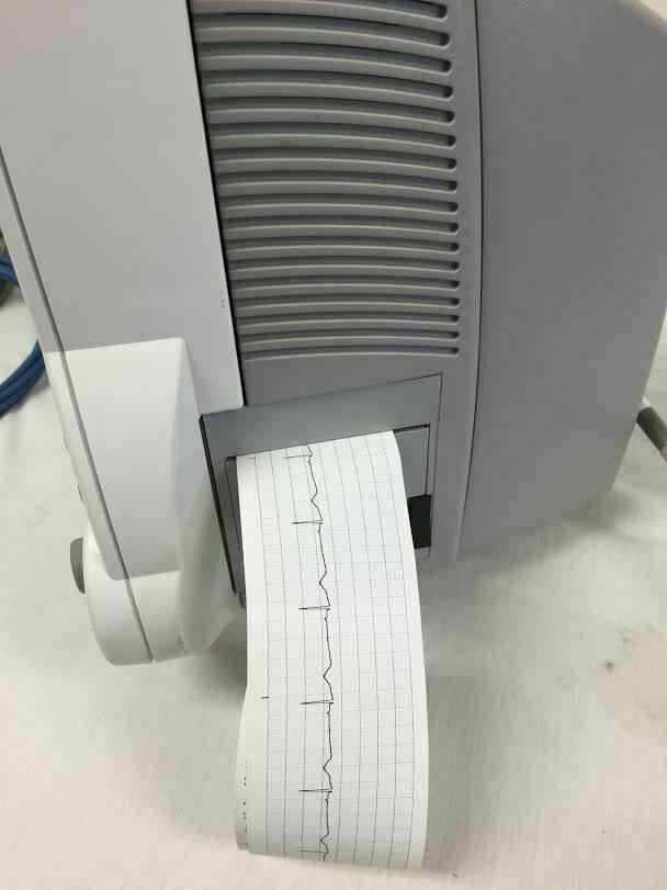 Philips Itellivue MP30 Bedside Patient Monitor